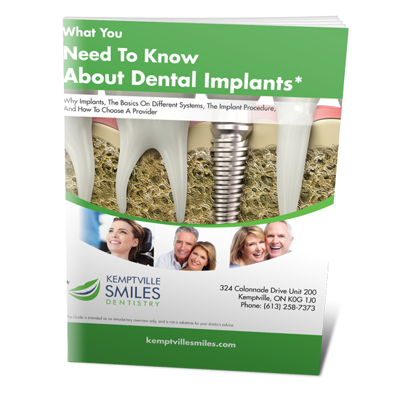 Dental implant guide in Kemptville